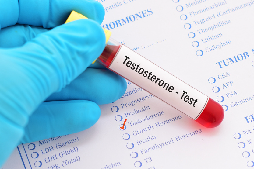 Testosterone test